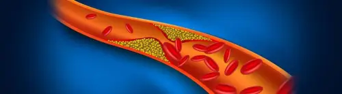 como bajar el colesterol