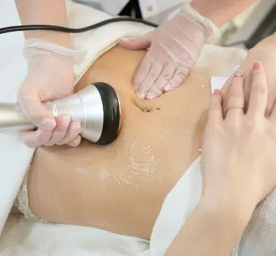 que es la cavitacion