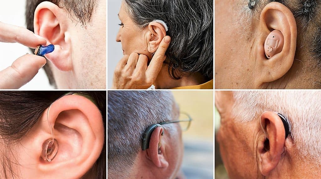 ¿Cómo saber que necesito prótesis auditiva? 1
